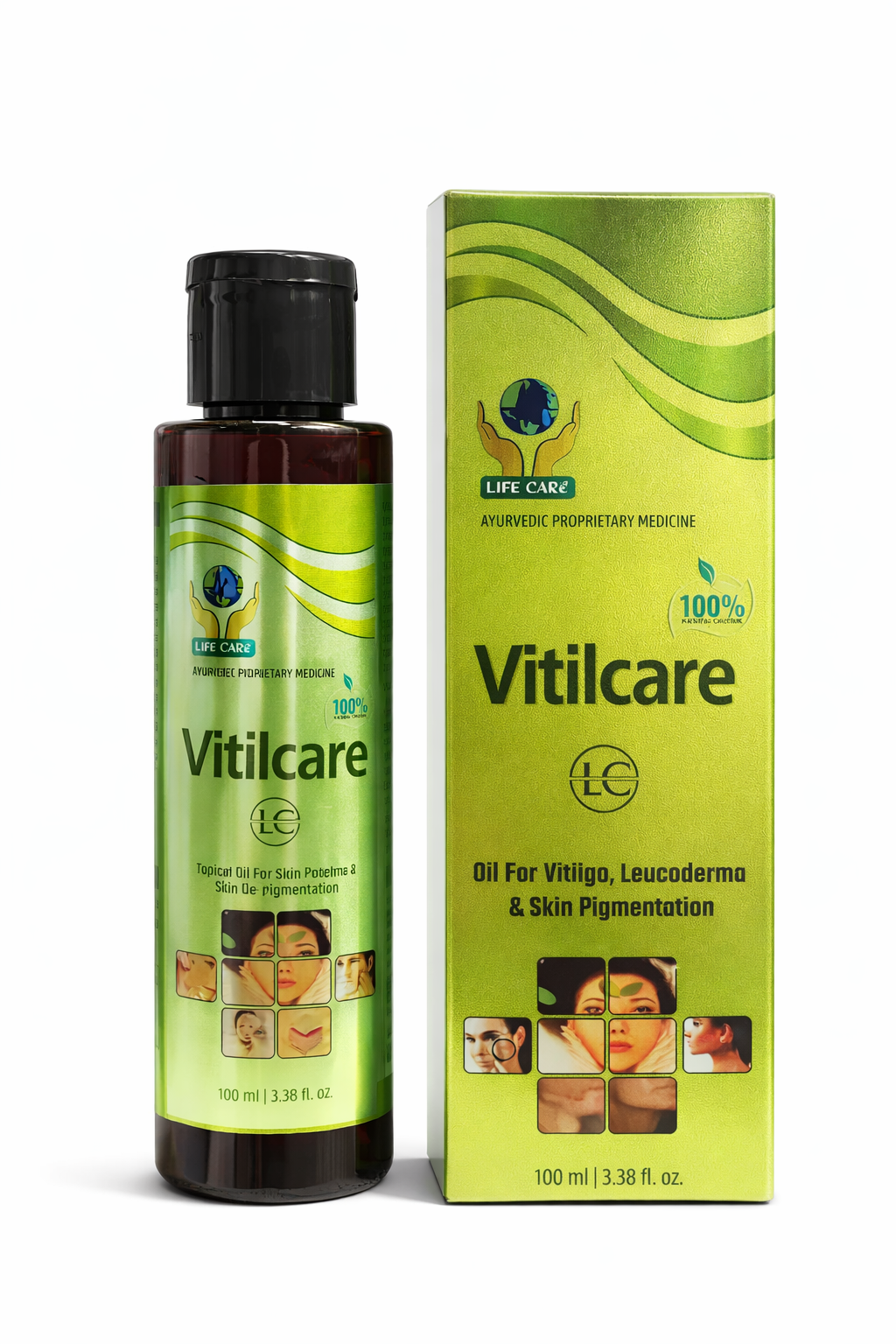 VITILCARE OIL vitiligo treatment