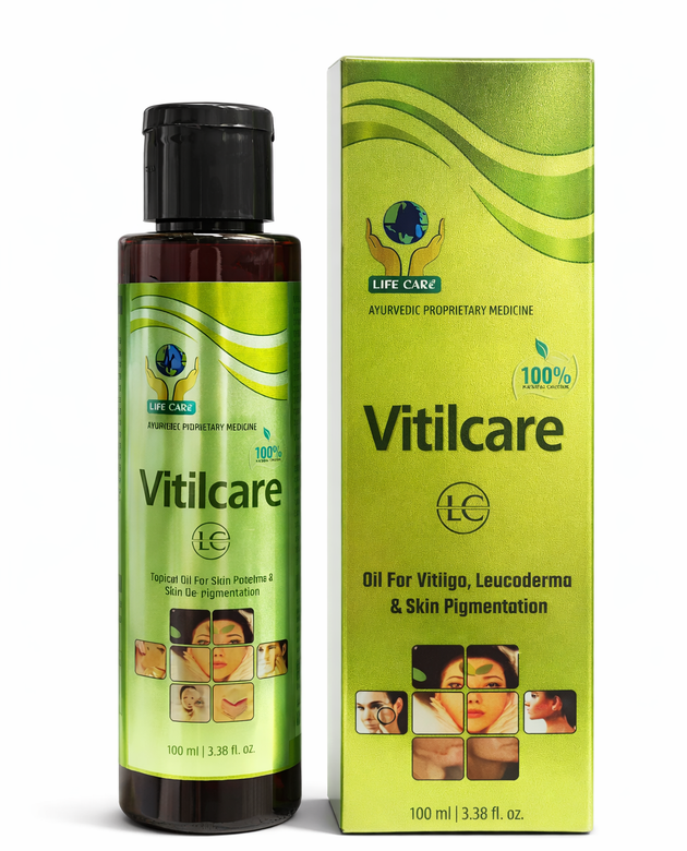VITILCARE OIL vitiligo treatment